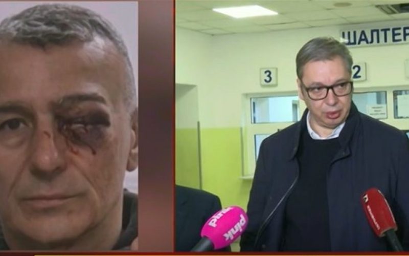 PITANJE JE DA LI ĆE LAZAR SAČUVATI OKO Vučić nakon obilaska policajca: Plenumaši provode nasilje ispred RTS